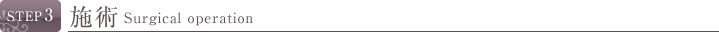 STEP3 施術体験